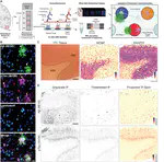 Influence of Alzheimer’s disease related neuropathology on local microenvironment gene expression in the human inferior temporal cortex