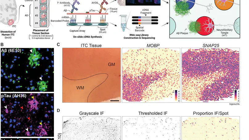 Influence of Alzheimer's Disease Related Neuropathology on Local Microenvironment Gene Expression in the Human Inferior Temporal Cortex