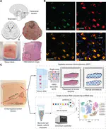 The gene expression landscape of the human locus coeruleus revealed by single-nucleus and spatially-resolved transcriptomics