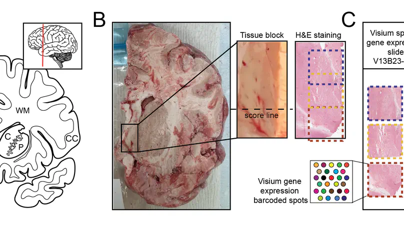 Integrating gene expression and imaging data across Visium capture areas with visiumStitched