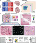 Impact of Alzheimer’s disease risk factors and local neuromelanin content on the transcriptomic landscape of the human locus coeruleus