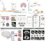 A molecular map of the living human brain from quantitative MRI