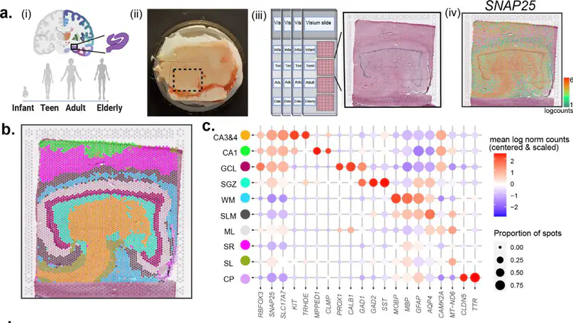 Spatiotemporal analysis of gene expression in the human dentate gyrus reveals age-associated changes in cellular maturation and neuroinflammation